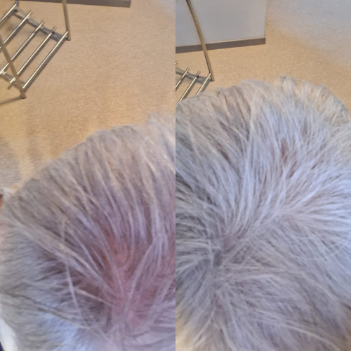 <p>Entdecken Sie, warum Frauen HairRich™ lieben </p>