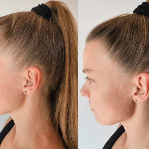 <p>Entdecken Sie, warum Frauen HairRich™ lieben </p>
