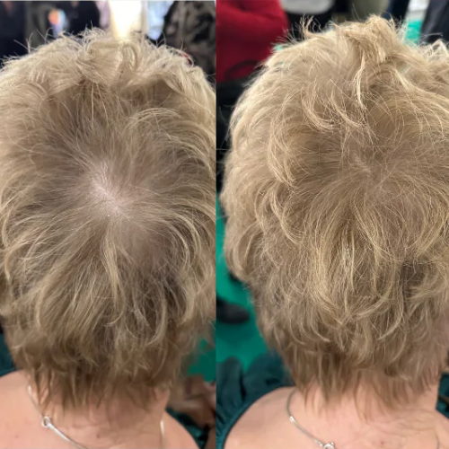 <p>Entdecken Sie, warum Frauen HairRich™ lieben </p>